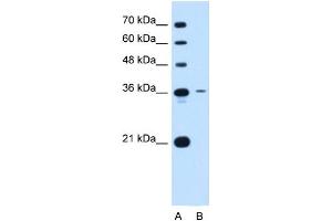 Tetraspanin 5 antibody used at 0. (Tetraspanin 5 antibody  (Middle Region))