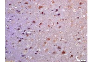 Formalin-fixed and paraffin embedded rat brain labeled with Anti-TSSC3 Polyclonal Antibody, Unconjugated (ABIN872459) at 1:200 followed by conjugation to the secondary antibody and DAB staining (PHLDA2 antibody  (AA 31-80))