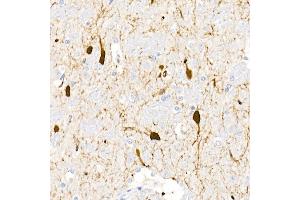 Immunohistochemistry of paraffin-embedded rat brain using DDC Rabbit pAb (ABIN1679510, ABIN3018150, ABIN3018151 and ABIN6220384) at dilution of 1:25 (40x lens). (DDC antibody  (AA 1-100))