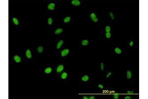 Image no. 3 for anti-DEAD (Asp-Glu-Ala-Asp) Box Polypeptide 54 (DDX54) (AA 778-882) antibody (ABIN599302) (DDX54 antibody  (AA 778-882))