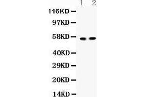 Anti-  ICA1 Picoband antibody, Western blottingAll lanes: Anti ICA1  at 0. (ICA1 antibody  (Middle Region))