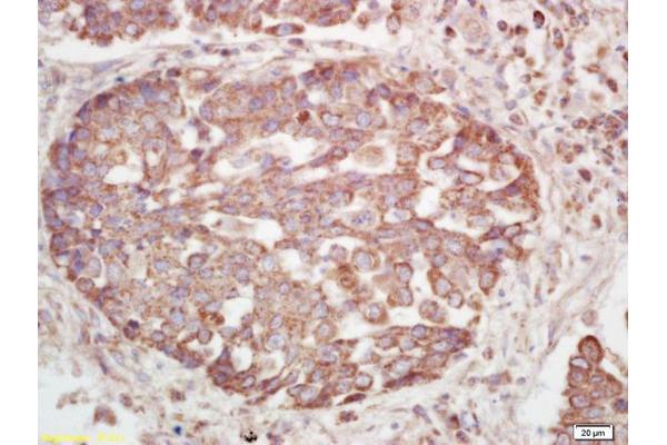 ISR-beta antibody  (pTyr1185)