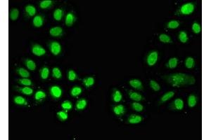 Immunofluorescent analysis of A549 cells using ABIN7161574 at dilution of 1:100 and Alexa Fluor 488-congugated AffiniPure Goat Anti-Rabbit IgG(H+L) (NAMPT antibody  (AA 1-280))