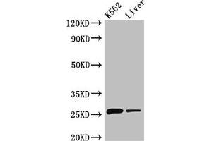 Western Blot Positive WB detected in: K562 whole cell lysate, Mouse liver tissue All lanes: NQO2 antibody at 3 μg/mL Secondary Goat polyclonal to rabbit IgG at 1/50000 dilution Predicted band size: 26 kDa Observed band size: 26 kDa (NQO2 antibody  (AA 1-231))