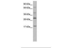 Image no. 1 for anti-PYD and CARD Domain Containing (PYCARD) (AA 71-120) antibody (ABIN202052) (PYCARD antibody  (AA 71-120))