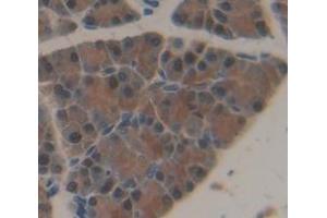 Figure. (PNPLA6 antibody  (AA 965-1137))