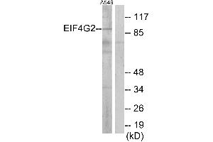 Western blot analysis of extracts from A549 cells, using EIF4G2 antibody.