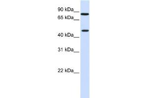 WB Suggested Anti-ZNF710 Antibody Titration:  0.