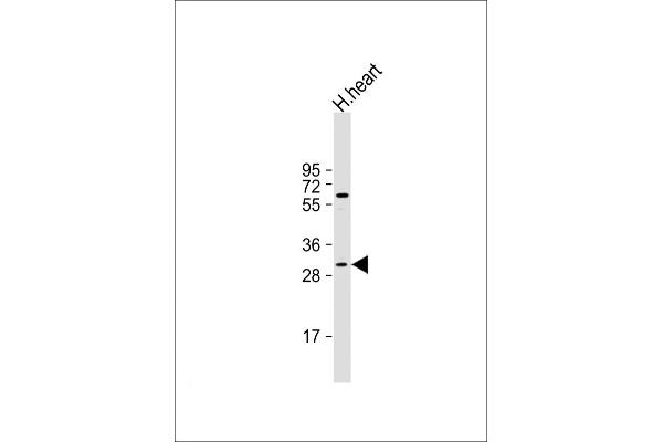 MEOX1 antibody  (N-Term)
