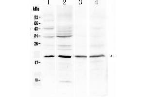 Western blot analysis of Myoglobin using anti-Myoglobin antibody . (MB antibody  (N-Term))