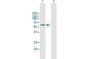 Western Blot analysis of KIR2DL5A expression in transfected 293T cell line by KIR2DL5A MaxPab polyclonal antibody.