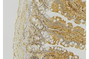 ABIN6276324 at 1/100 staining Mouse colon tissue by IHC-P. (KRT20 antibody  (C-Term))