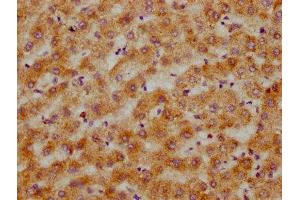 IHC image of ABIN7148519 diluted at 1:200 and staining in paraffin-embedded human liver tissue performed on a Leica BondTM system.