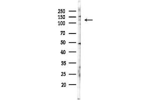 anti-rho GTPase Activating Protein 20 (ARHGAP20) (Internal Region) antibody