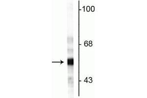 Western blot of rat cerebellar lysate showing specific immunolabeling of the ~57 kDa peripherin protein.