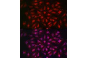 Immunofluorescence analysis of U2OS cells using KPNB1 Rabbit pAb (ABIN6134722, ABIN6142997, ABIN6142998 and ABIN6224723) at dilution of 1:100 (40x lens). (KPNB1 antibody  (AA 250-350))