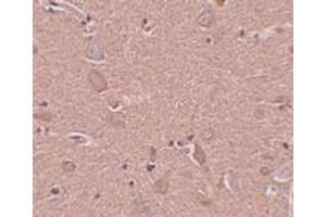 Immunohistochemistry (IHC) image for anti-Sushi-Repeat Containing Protein, X-Linked (SRPX) (N-Term) antibody (ABIN1031585) (SRPX antibody  (N-Term))