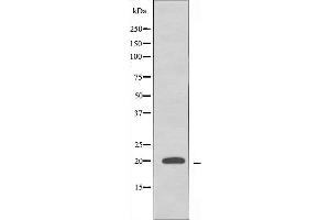 RPL10L anticorps  (C-Term)
