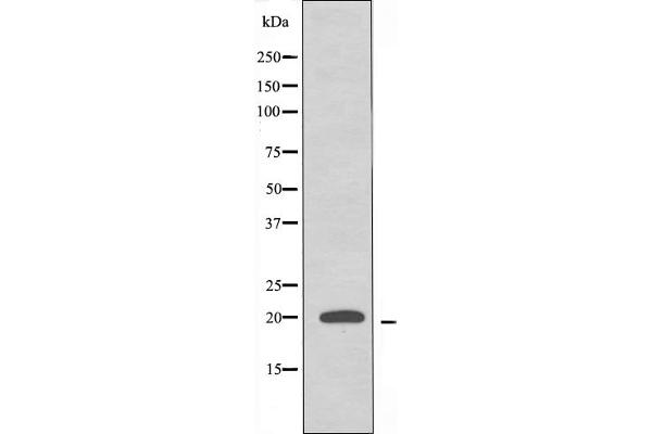 RPL10L antibody  (C-Term)