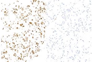 Immunocytochemistry (ICC) image for anti-Selectin E (SELE) (AA 22-555) antibody (ABIN7795699) (Recombinant Selectin E/CD62e antibody  (AA 22-555))