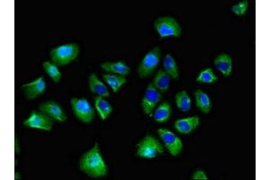 Immunofluorescent analysis of A549 cells using ABIN7170645 at dilution of 1:100 and Alexa Fluor 488-congugated AffiniPure Goat Anti-Rabbit IgG(H+L) (SPRED1 antibody  (AA 123-311))