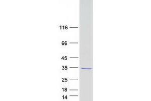 Western Blotting (WB) image for Receptor Accessory Protein 4 (REEP4) protein (Myc-DYKDDDDK Tag) (ABIN2730679)