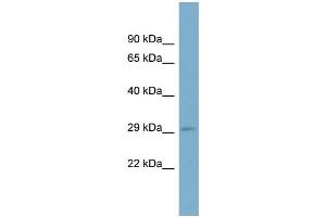 WB Suggested Anti-RAB23 Antibody Titration: 0.