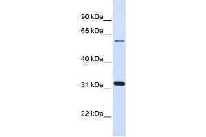 LGALS3 antibody used at 1 ug/ml to detect target protein. (Galectin 3 antibody  (N-Term))