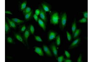 Immunofluorescence staining of Hela cells with ABIN7145788 at 1:66, counter-stained with DAPI. (BRE antibody  (AA 94-383))