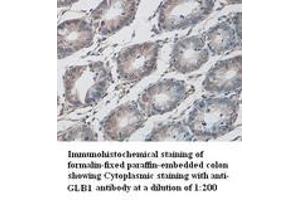 Image no. 1 for anti-Galactosidase, beta 1 (GLB1) (C-Term) antibody (ABIN791018) (GLB1 antibody  (C-Term))