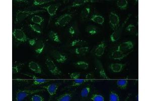 Immunofluorescence analysis of U-2 OS cells using ETFB Polyclonal Antibody at dilution of 1:100 (40x lens). (ETFB antibody)