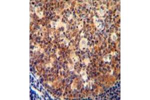 Immunohistochemistry analysis in human tonsil tissue (formalin-fixed, paraffin-embedded) using Interleukin-12 beta/IL12B Antibody (C-term), followed by peroxidase conjugation of the secondary antibody and DAB staining.