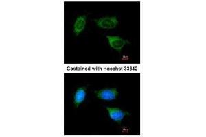 ICC/IF Image Immunofluorescence analysis of methanol-fixed HeLa, using ATP synthase B1, antibody at 1:200 dilution. (ATP Synthase B1 (Center) antibody)