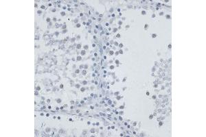 Immunohistochemistry of paraffin-embedded rat testis using MSH6 antibody (ABIN7268710) at dilution of 1:100 (40x lens). (MSH6 antibody  (AA 1-290))