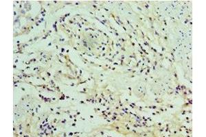 Immunohistochemistry of paraffin-embedded human epityphlon tissue using ABIN7169332 at dilution of 1:100 (SERPINA12 antibody  (AA 20-320))