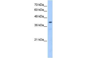 POMT2 antibody used at 0. (POMT2 antibody  (Middle Region))