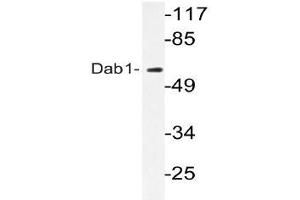 Western blot (WB) analyzes of Dab1 antibody in extracts from HepG2 cells. (DAB1 antibody)