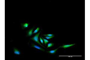 Immunofluorescence of purified MaxPab antibody to NR4A2 on HeLa cell. (NR4A2 antibody  (AA 1-598))