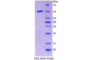 SDS-PAGE analysis of Human NPC2 Protein.