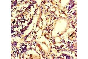 Immunohistochemistry of paraffin-embedded human appendix tissue using ABIN7147801 at dilution of 1:100 (IRG1 antibody  (AA 57-257))
