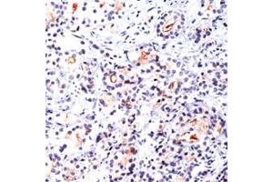 Immunohistochemistry (IHC) image for anti-Folate Hydrolase (Prostate-Specific Membrane Antigen) 1 (FOLH1) (C-Term) antibody (ABIN2470727) (PSMA antibody  (C-Term))