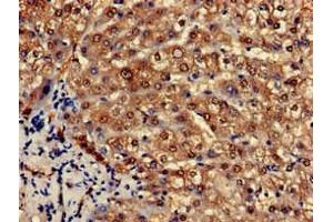 Immunohistochemistry of paraffin-embedded human liver tissue using ABIN7164812 at dilution of 1:100 (PCCA antibody  (AA 585-720))