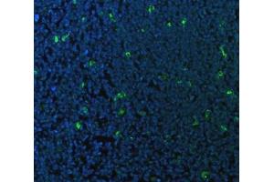 IF analysis of CD68 using anti-CD68 antibody (ABIN7600142). (CD68 antibody  (AA 154-354))