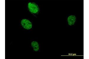 Immunofluorescence of purified MaxPab antibody to RBM5 on HeLa cell. (RBM5 antibody  (AA 1-546))