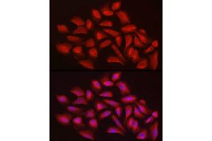 Immunofluorescence analysis of U2OS cells using EXT1 Rabbit pAb (ABIN3022736, ABIN3022737, ABIN3022738 and ABIN6219202) at dilution of 1:100 (40x lens).