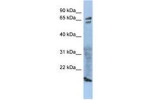 Image no. 1 for anti-Zona Pellucida Glycoprotein 1 (ZP1) (AA 215-264) antibody (ABIN6743944) (ZP1 antibody  (AA 215-264))