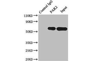 Immunoprecipitating PAK2 in Raji whole cell lysate Lane 1: Rabbit control IgG instead of ABIN7127664 in Raji whole cell lysate. (Recombinant PAK2 antibody)