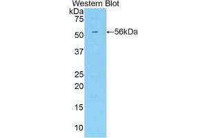 Western blot analysis of the recombinant protein. (KIR3DL2 antibody  (AA 184-435))
