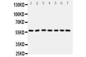 Anti-CYP11B1 antibody, Western blottingAll lanes: Anti CYP11B1  at 0. (CYP11B1 antibody  (C-Term))