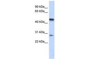 Image no. 1 for anti-Chromosome 13 Open Reading Frame 31 (C13orf31) (AA 179-228) antibody (ABIN6743720) (LACC1 antibody  (AA 179-228))